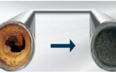 Descalcificación en Ciudad Lineal